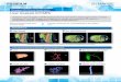 Liver Analysis (CT/MR) - Fujifilm Healthcare