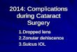 2014: Complications during Cataract Surgery