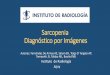 Sarcopenia - diagnóstico por imágenes