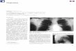 La tomografia axial computarizada en patologia toracia