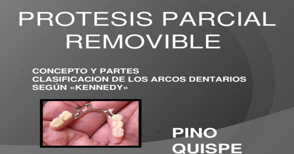 Mccracken Protesis Parcial Removible 11 Edicion Pdf Trakaxpc 3 01
